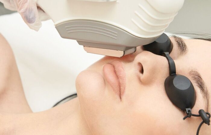 Hair removal page showcasing the laser hair removal on female model