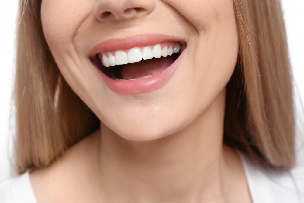 hollywood smile showing female model smiling with confidence