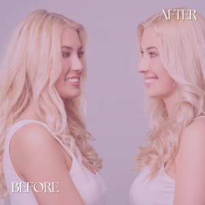 London Aesthetics hair care before and after 