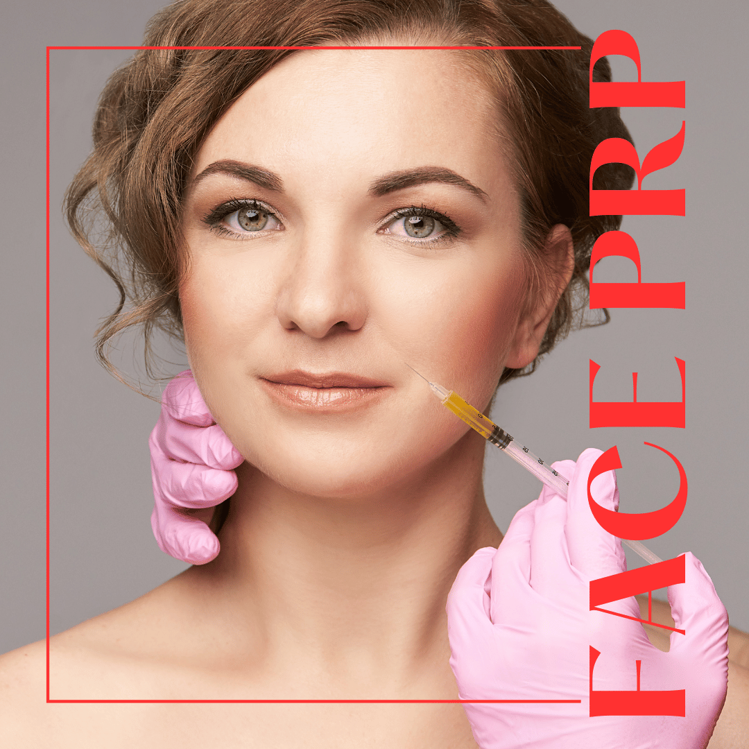 Face PRP London Aesthetics Pakistan
