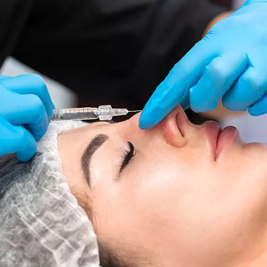 rhinoplasty