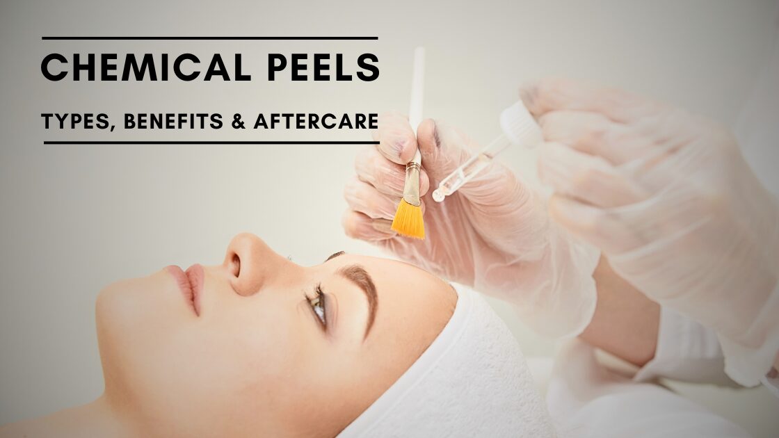 Chemical Peels page showcasing text and female model going through chemical peels procedure