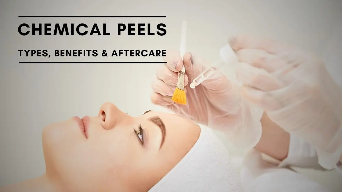 Chemical Peels page showcasing text and female model going through chemical peels procedure