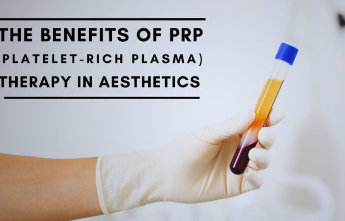 The Benefits of PRP