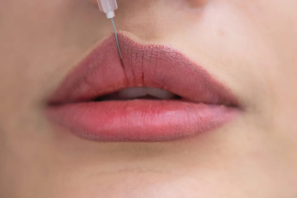 A thoughtful Grecian esthetician gazes into a mirror, her curly hair framing her face. Holding a beauty injection syringe, she contemplates the ideal treatment.