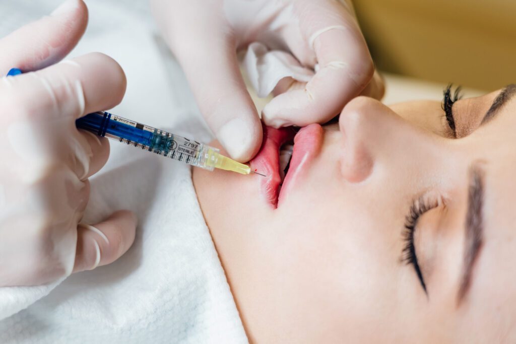 Close up of hands of cosmetologist making injection in female lips. She is holding syringe. Closeup of an aesthetician expert's hands injecting in female lips. Lip Filler visuals