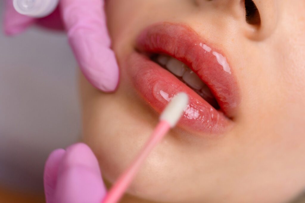 Injection procedure for lip augmentation, close-up. The cosmetologist slowly and carefully injects filler into the client lips. Advertising concept for facial care, youth and beauty.